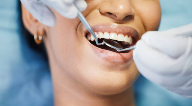 Best Emergency Wisdom Teeth Removal in Mclouth, KS