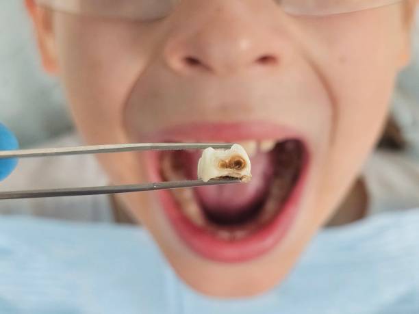 Best Emergency Dental Care for Trauma or Injury in Mclouth, KS